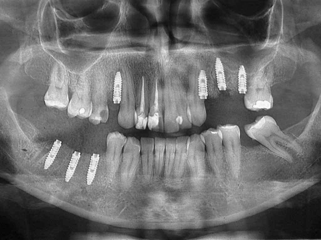 Clinical Implantology Training
