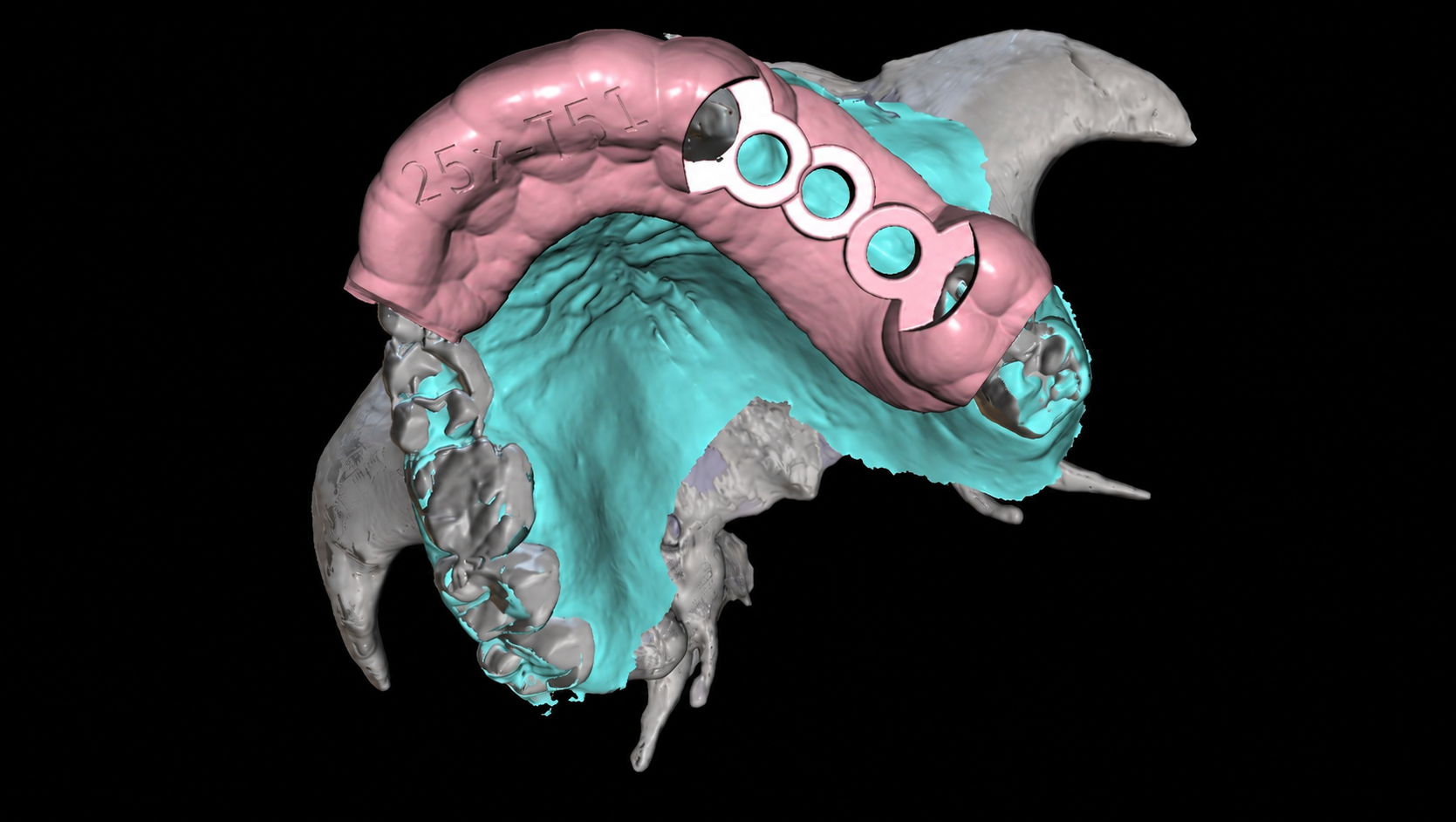 Guided Surgery Training